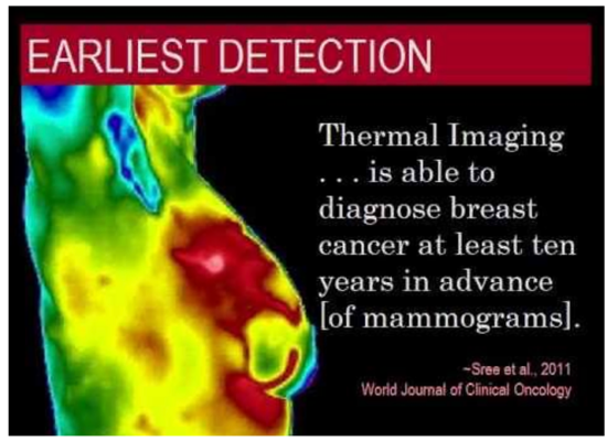Mammograms and Breast Cancer Risk